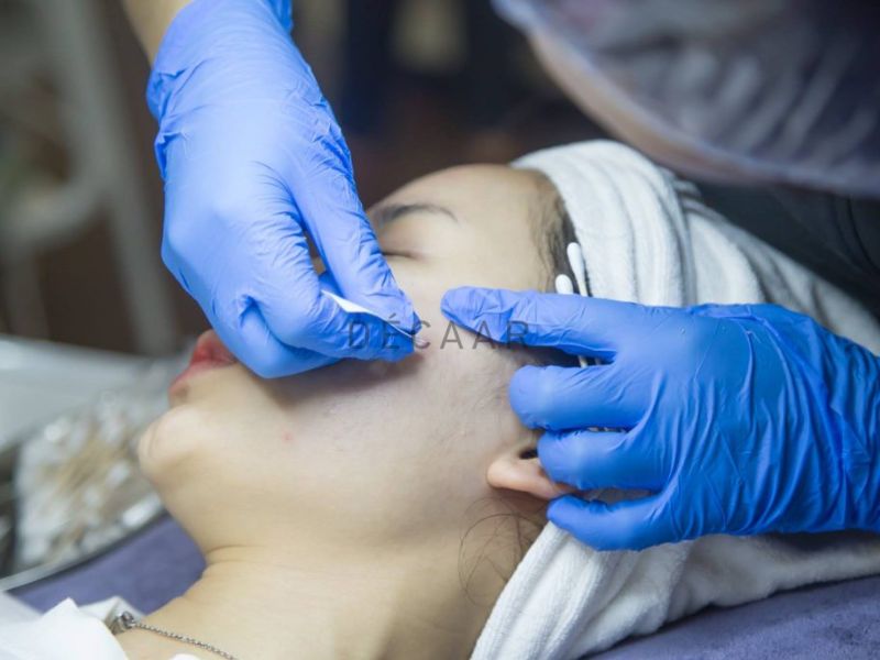 Điều trị mụn tại phòng khám